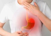 برای کاهش اسید معده چه بخوریم؟ ۵ راهکار برای کاهش فوری اسید معده