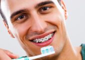 بهترین خمیردندان برای ارتودنسی چه ویژگی‌هایی دارد؟ معرفی 4 خمیردندان ارتودنسی