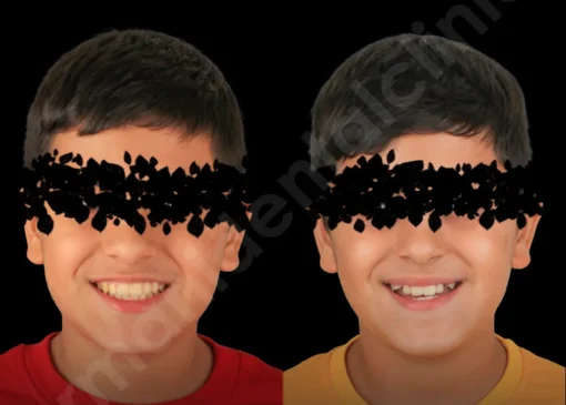 ارتودنسی دندان چیست و دقیقا چه کاری انجام می‌دهد؟