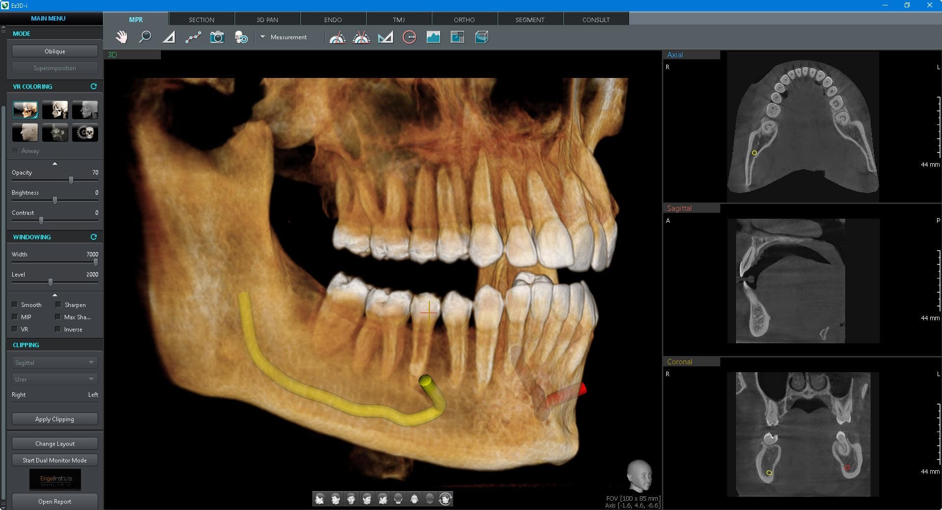 روش عکسبرداری CBCT