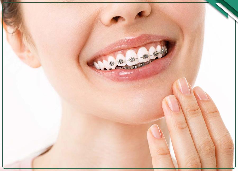 تاثیر استرس بر درمان ارتودنسی + روشهای مقابله با آن