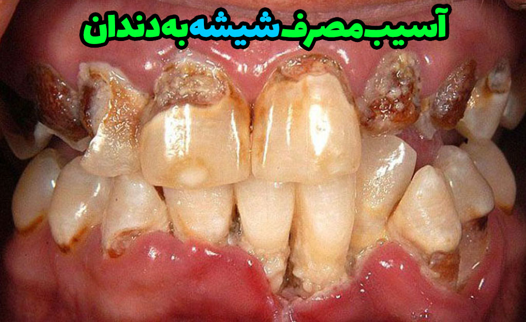 علائم-فرد-معتاد-به-شیشه