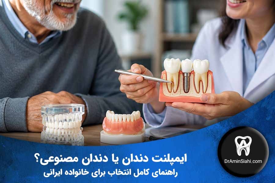 مقایسه ایمپلنت دندان و دندان مصنوعی