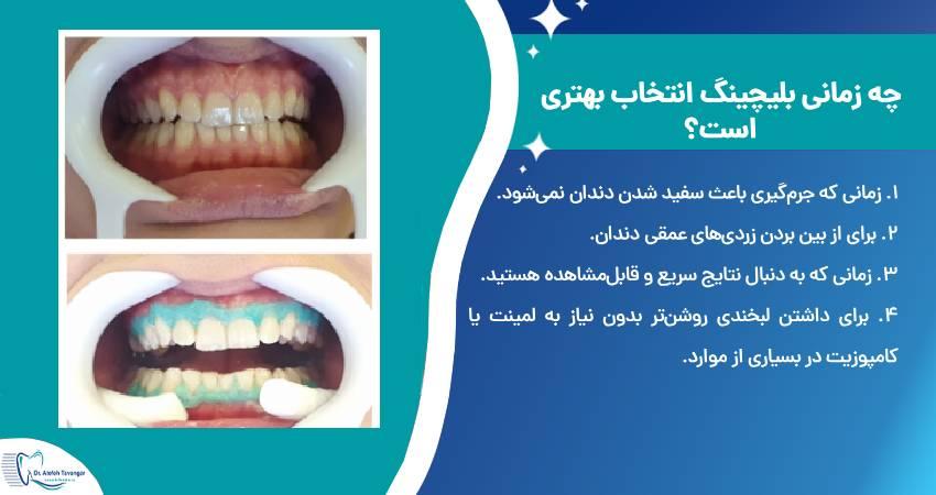 چه زمانی بلیچینگ انتخاب بهتری است