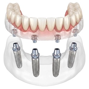 ساختار اوردنچر
