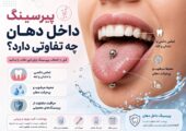 راهنمای پیرسینگ داخل دهان و تفاوت پیرسینگ زبان با سایر پیرسینگ‌ها