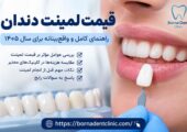 قیمت لمینت دندان: راهنمای کامل و واقع‌بینانه برای سال ۱۴۰۵