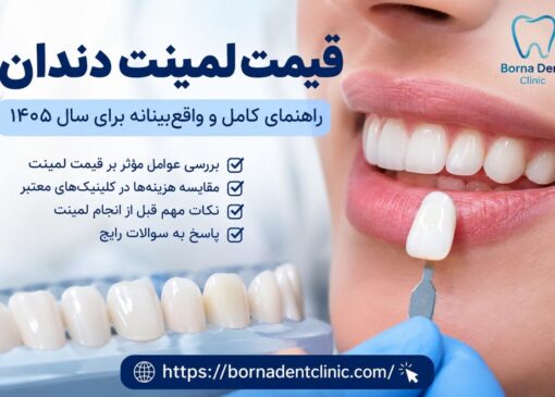 قیمت لمینت دندان: راهنمای کامل و واقع‌بینانه برای سال ۱۴۰۵