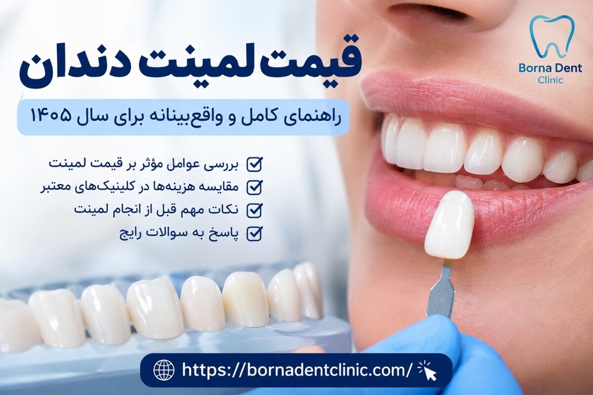 قیمت لمینت دندان: راهنمای کامل و واقعبینانه برای سال ۱۴۰۵