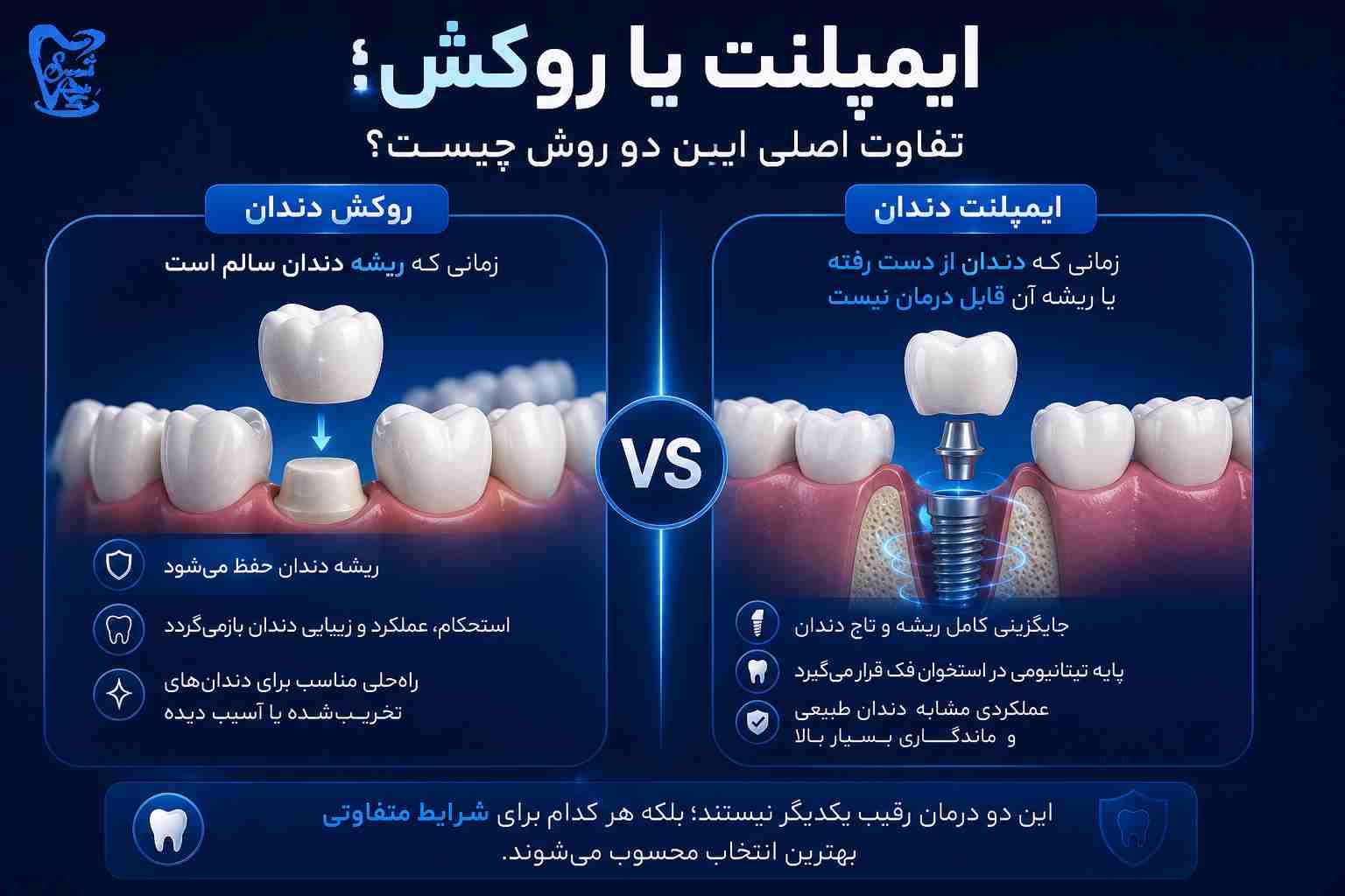 ایمپلنت یا روکش؟