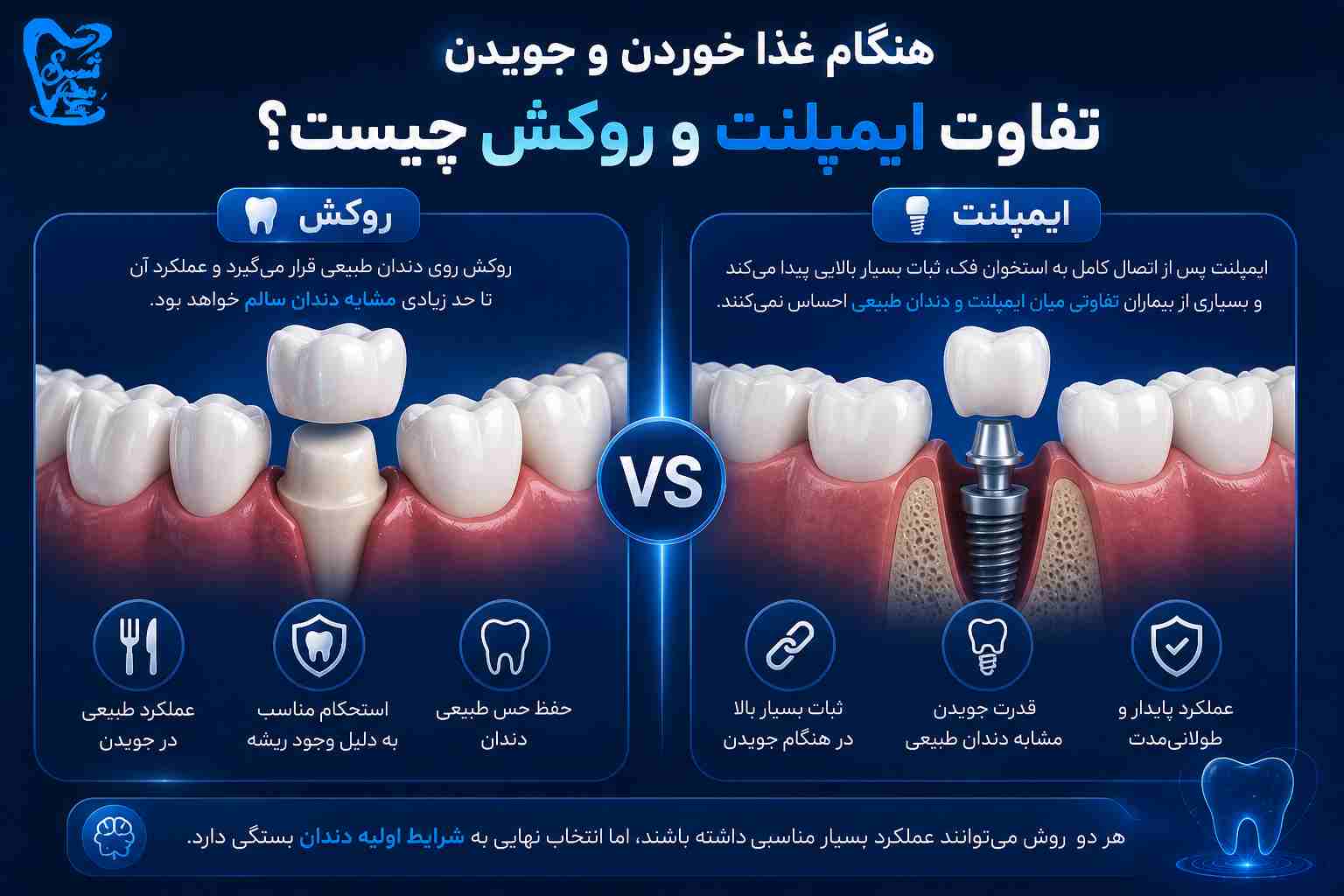 تفاوت ایمپلنت و روکش