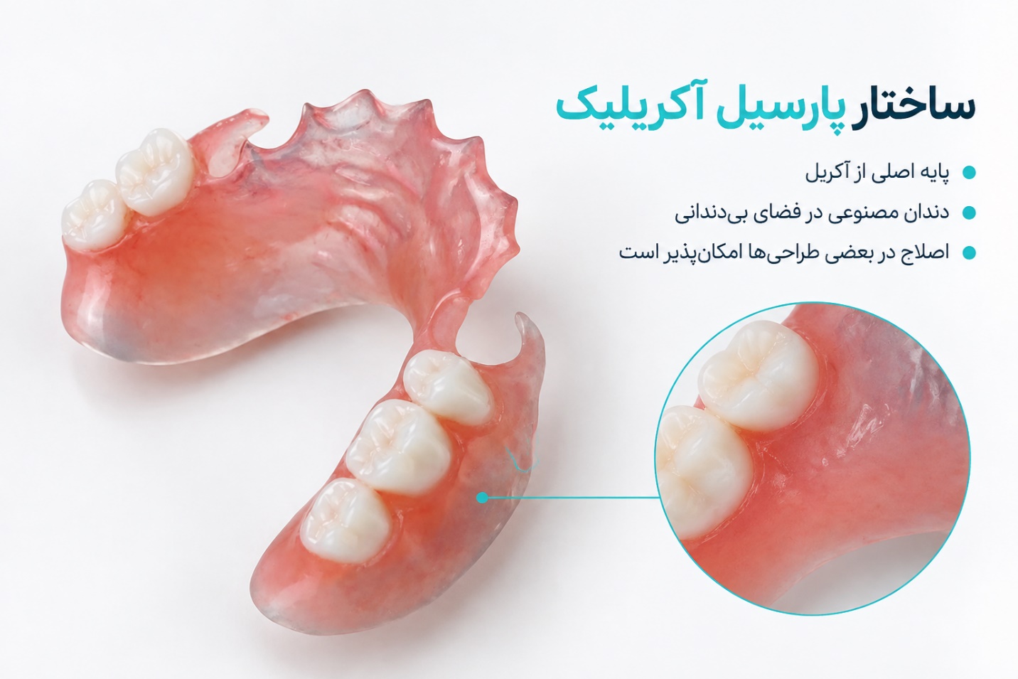 پروتز پارسیل آکریلیک برای جایگزینی چند دندان از دست رفته