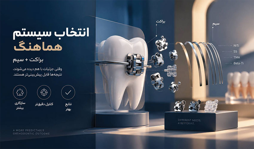 انتخاب هماهنگ براکت و سیم ارتودنسی