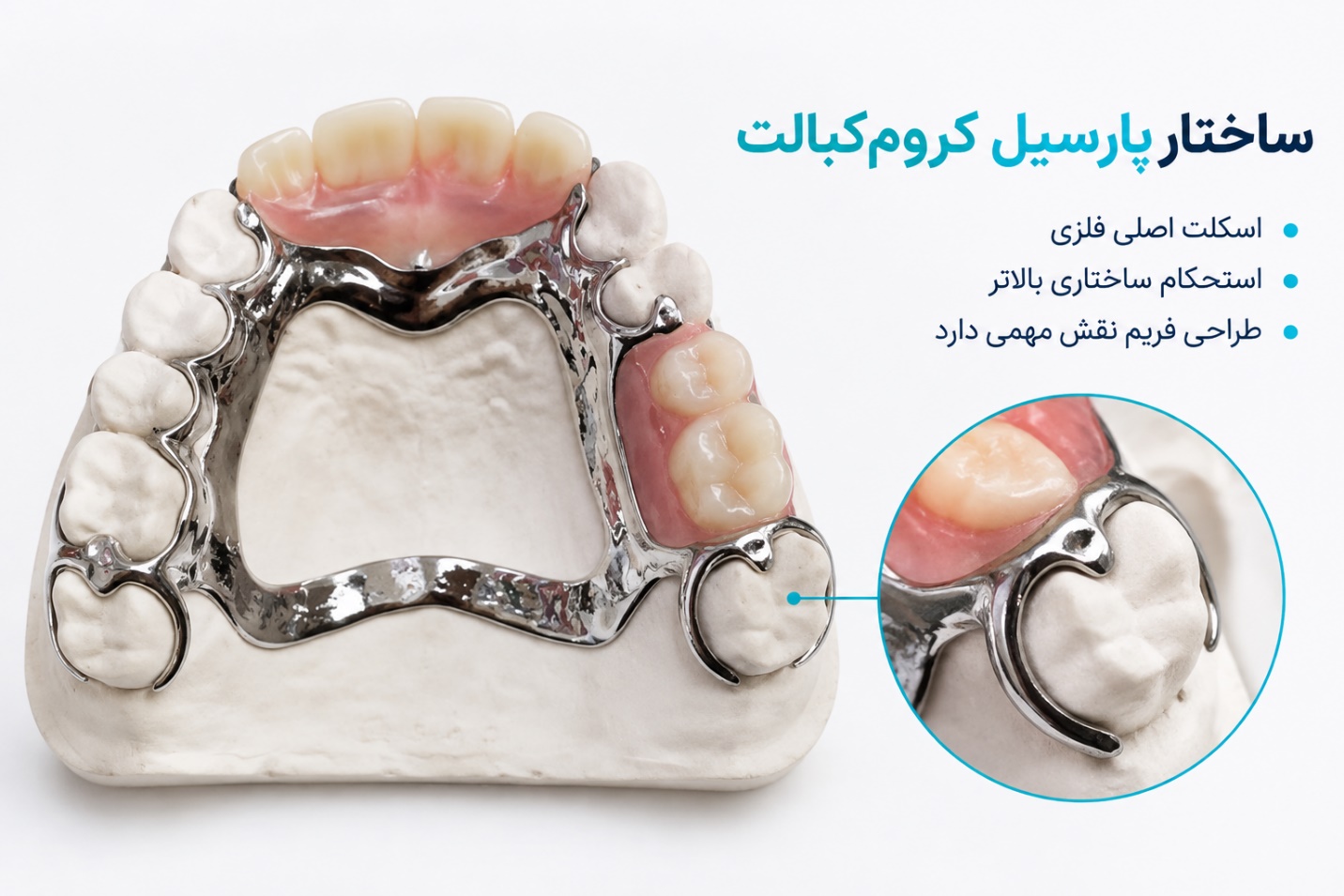 دندان مصنوعی پارسیل کروم کبالت با فریم فلزی